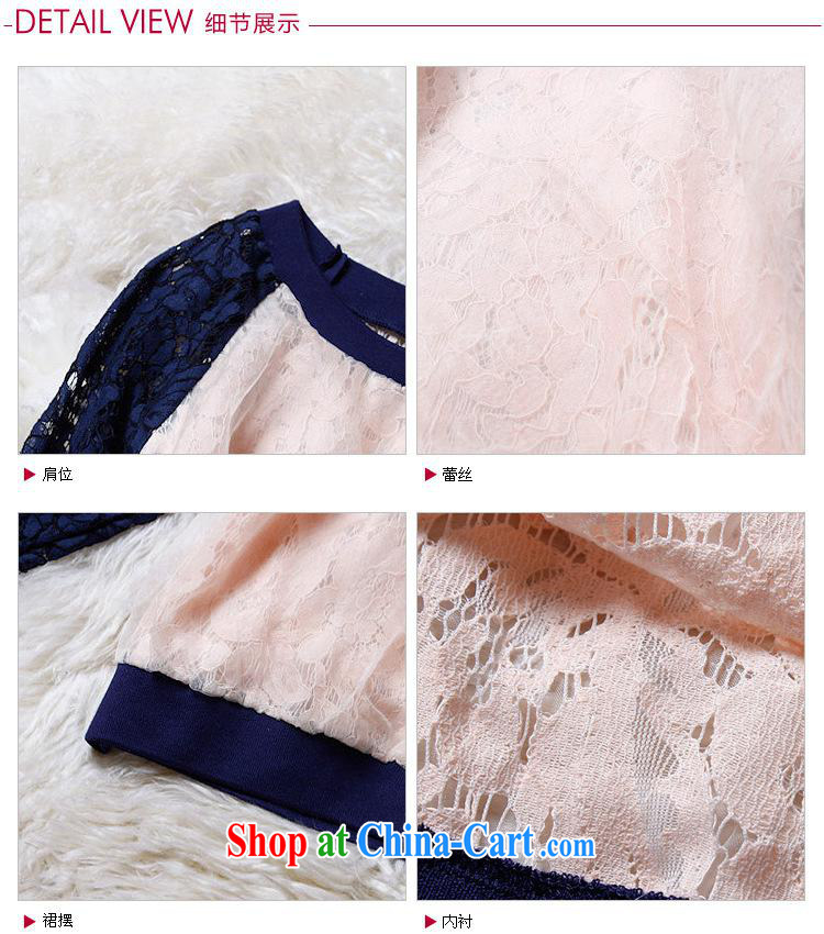 9 month dress * LP DaieR Diana's fashion 2015 spring and summer new European site lace stitching round collar T-shirt 151,727 pink L pictures, price, brand platters! Elections are good character, the national distribution, so why buy now enjoy more preferential! Health